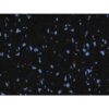 Vortex Rubber Rolls Black with Blue Specks VS101 8mm